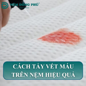 cach tay vet mau tren nem 1